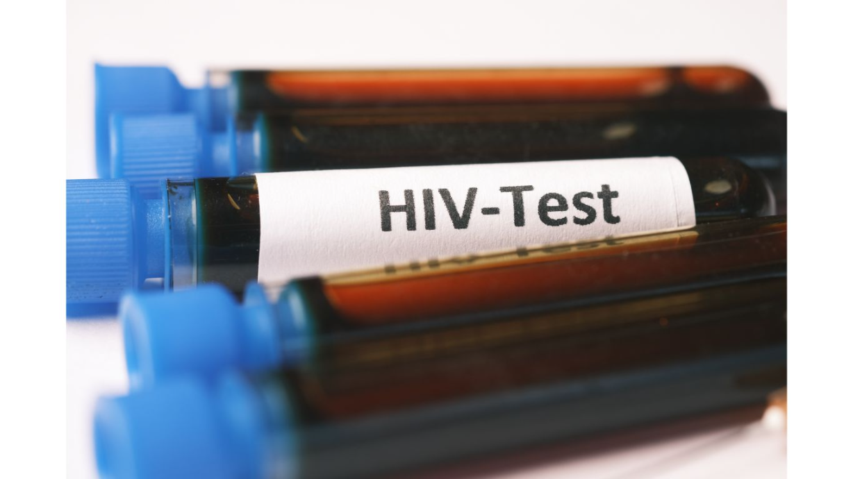 Fiolkowe probówki z niebieskimi zakrętkami. Jedna z nich posiada etykietę z napisem "HIV-Test". W probówkach znajduje się ciemny płyn, prawdopodobnie próbki krwi.