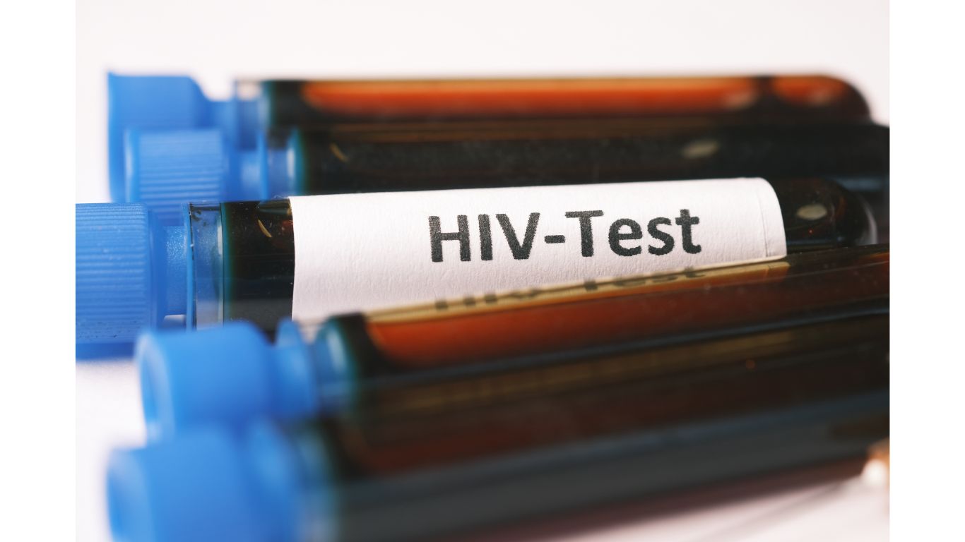 Na zdjęciu fiolki z krwia do badania opisane hiv test