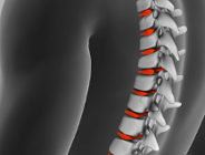Bezpłatne badania diagnostyczne w kierunku wykrywania osteoporozy