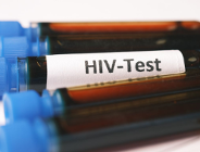 HIV/AIDS - wciąż aktualne wyzwanie zdrowia publicznego