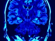 Poznańscy neurolodzy pracują nad stworzeniem multimedialnego konsultanta